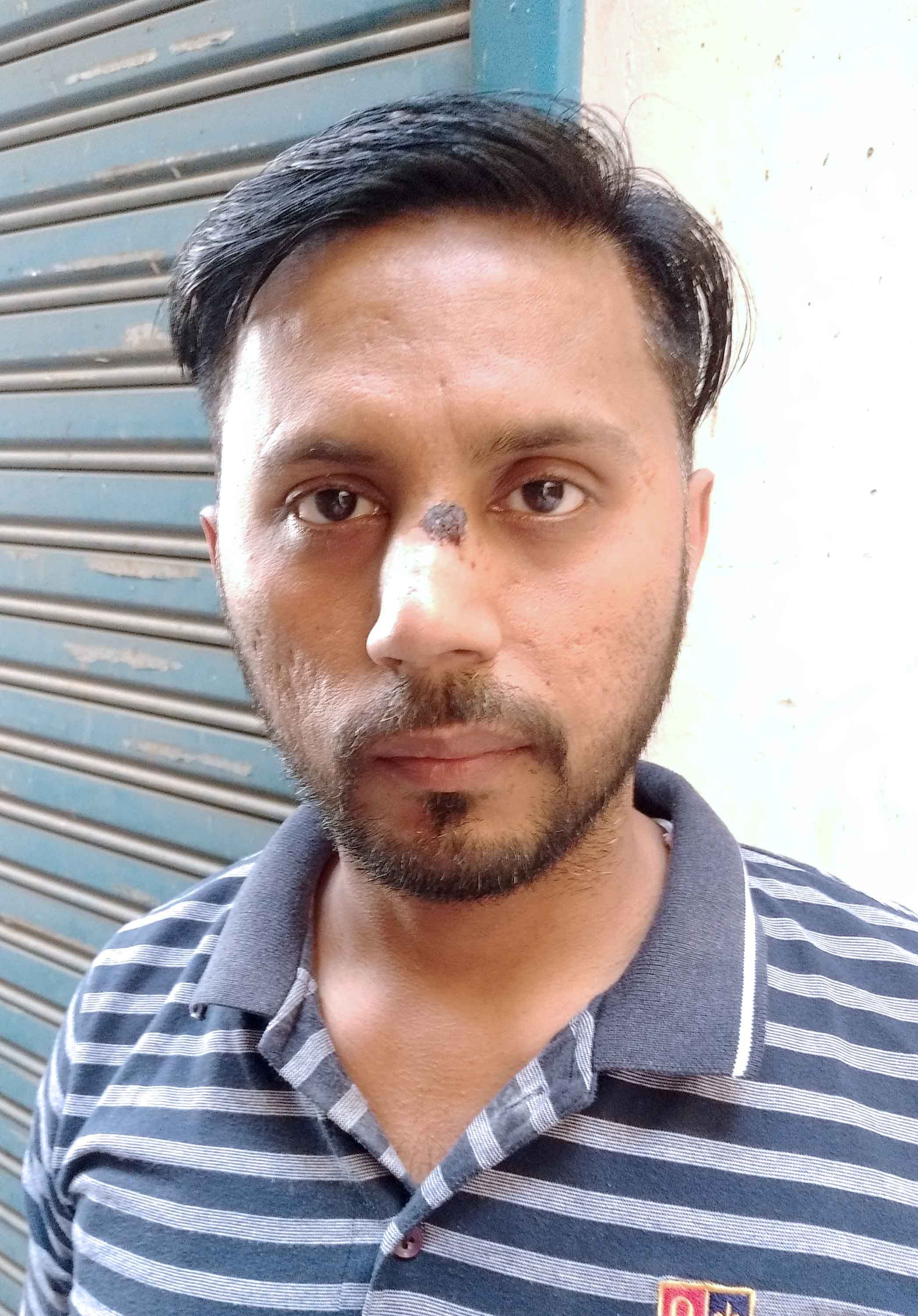 डॉ. अशोक कुमार, सारवाल अस्पताल अंबाला सिटी।
