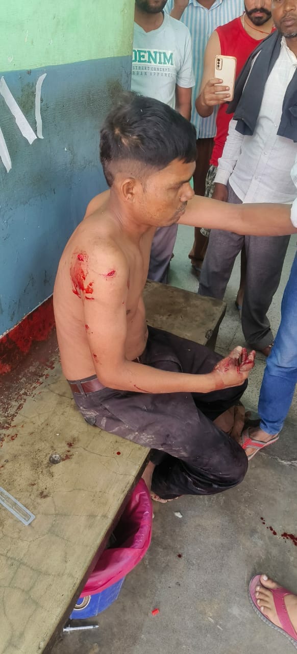 बाघ हमले में घायल शशिकांत। बाघ हमले में घायल शशिकांत।