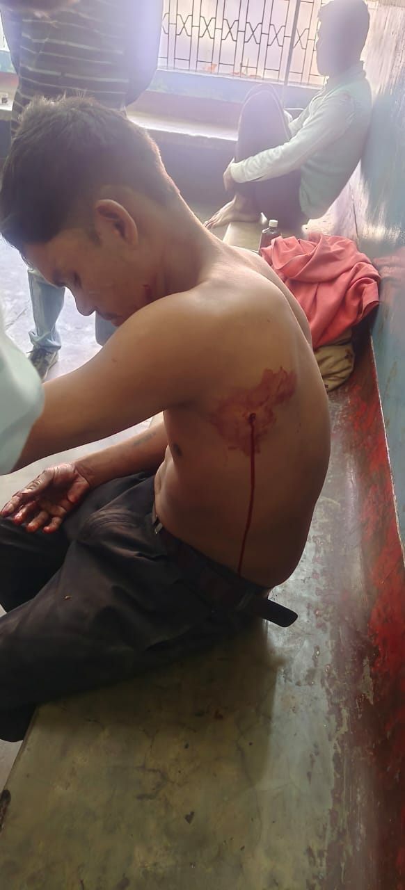 बाघ हमले में घायल शशिकांत। बाघ हमले में घायल शशिकांत।