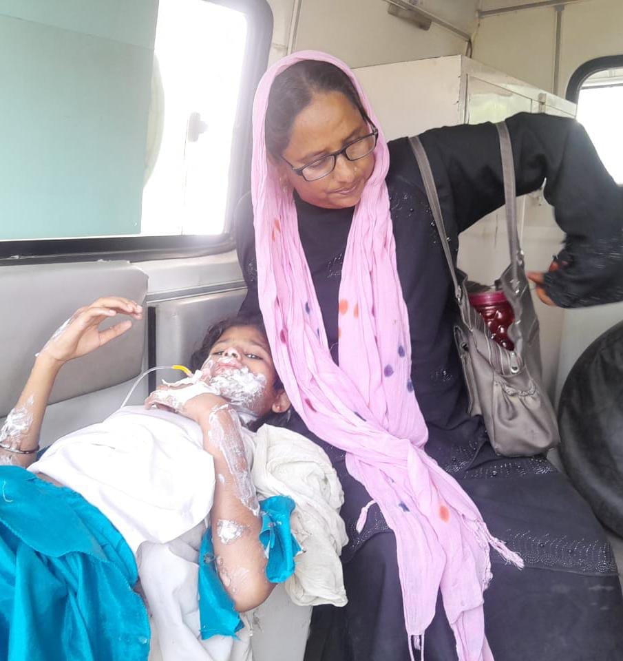 न्यूरिया सीएचसी में उपचार लेते झ़लसे लोग । स्रोत - कर्मचारी न्यूरिया सीएचसी में उपचार लेते झ़लसे लोग । स्रोत - कर्मचारी