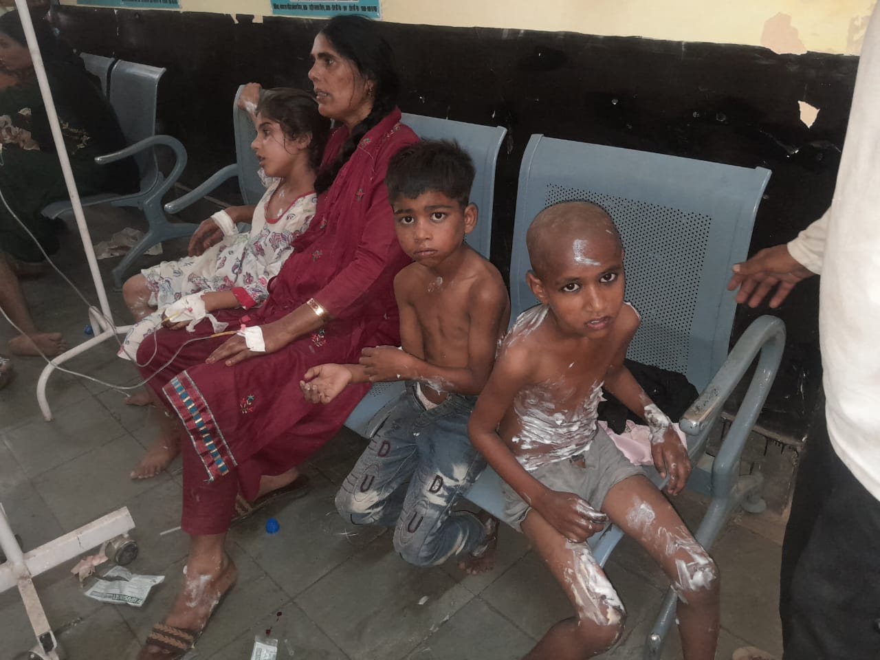 न्यूरिया सीएचसी में उपचार लेते झ़लसे लोग । स्रोत - कर्मचारी न्यूरिया सीएचसी में उपचार लेते झ़लसे लोग । स्रोत - कर्मचारी