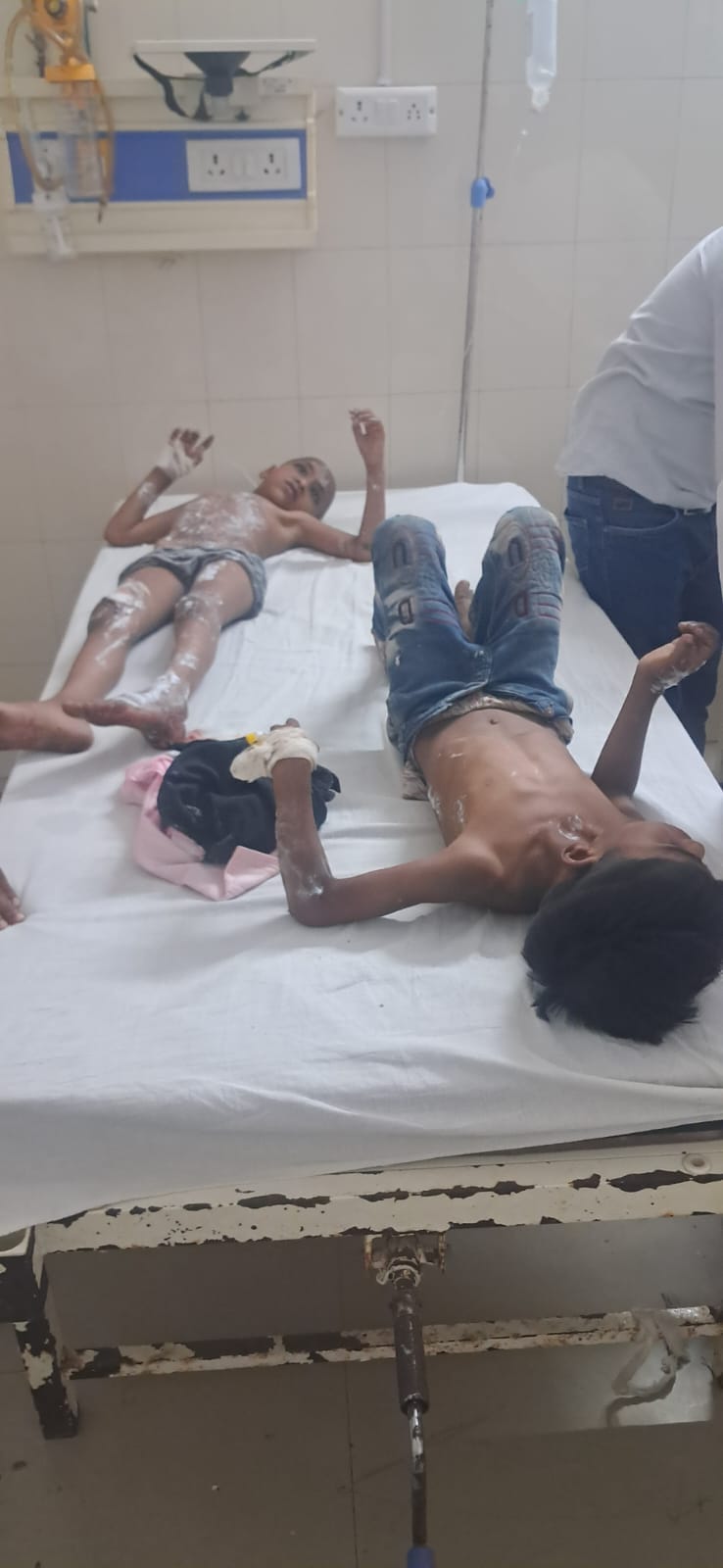 न्यूरिया सीएचसी में उपचार लेते झ़लसे लोग । स्रोत - कर्मचारी न्यूरिया सीएचसी में उपचार लेते झ़लसे लोग । स्रोत - कर्मचारी