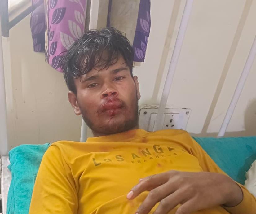 बरखेड़ा सीएचसी में भर्ती घायल राकेश।