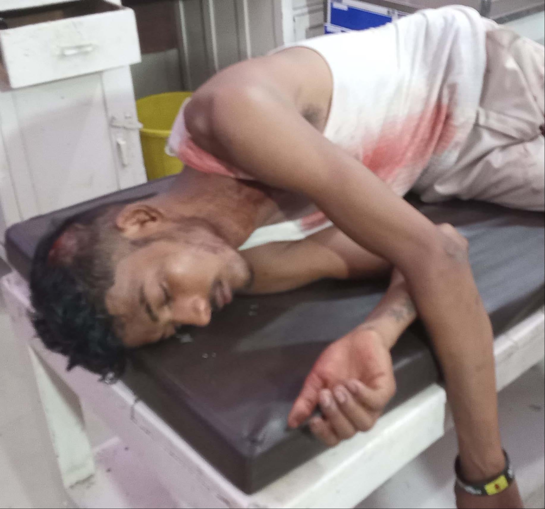 शामली मार पिटाई में घायल महिलाएं शामली मार पिटाई में घायल महिलाएं