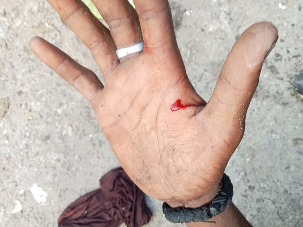 जोनल अस्पताल में कूड़े के साथ डाली इस्तेमाह की गईं सिरिंज। स्त्रोत सफाई कर्मचारी जोनल अस्पताल में कूड़े के साथ डाली इस्तेमाह की गईं सिरिंज। स्त्रोत सफाई कर्मचारी