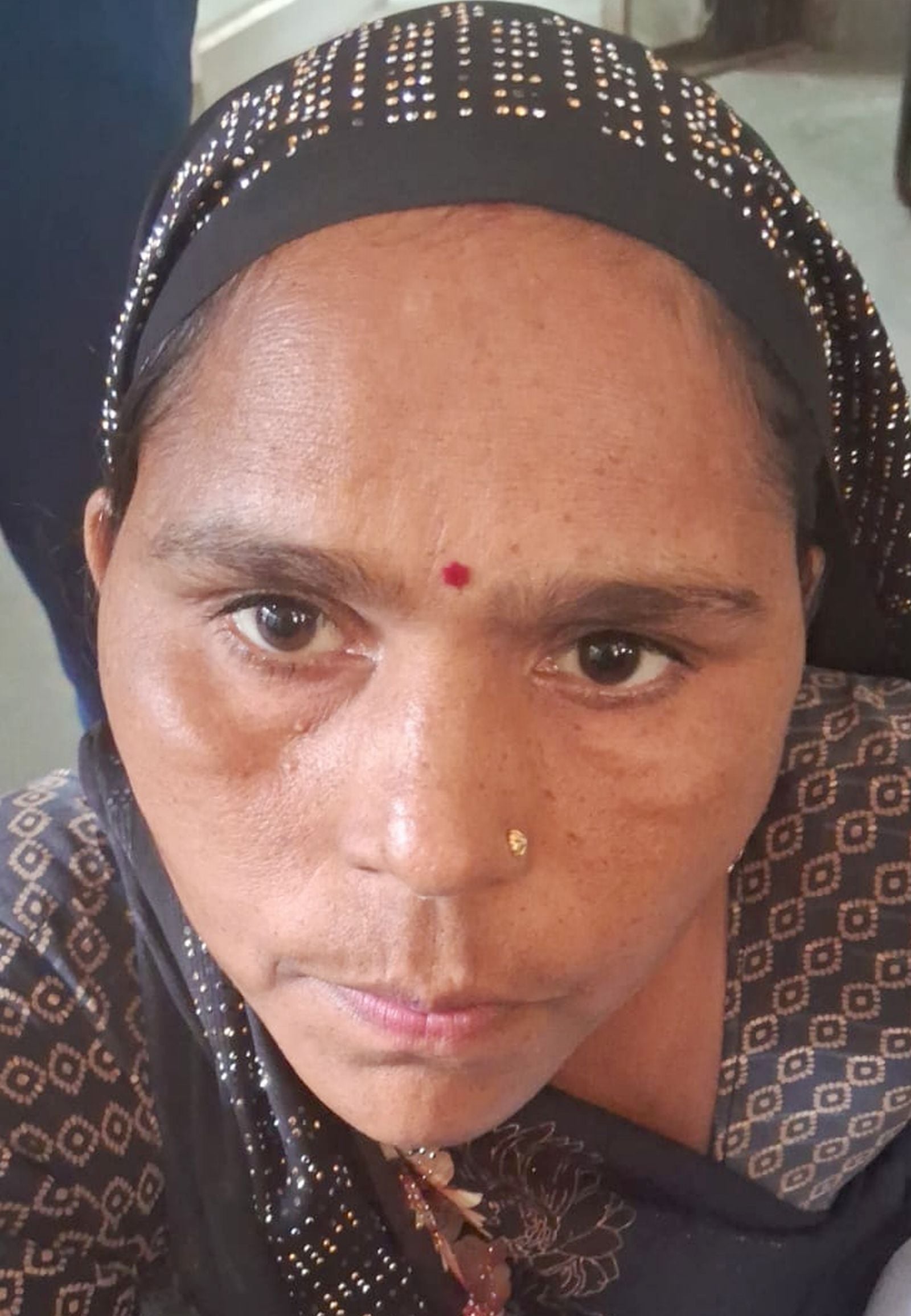 जिला अस्पताल के टीबी वार्ड में लगी मरीजों की कतार। संवाद जिला अस्पताल के टीबी वार्ड में लगी मरीजों की कतार। संवाद
