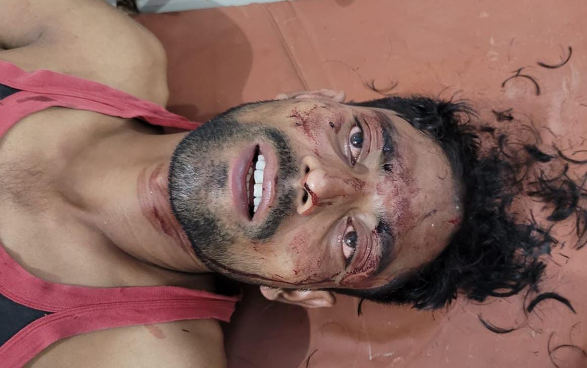 पीलीभीत के जिला चिकित्सालय में मौजूद घायल के परिजन।स्रोत:सोशल मीडिया पीलीभीत के जिला चिकित्सालय में मौजूद घायल के परिजन।स्रोत:सोशल मीडिया