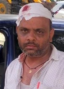 रसूलपुर गिरसा में पिटाई से घायल गुलाब पासी। रसूलपुर गिरसा में पिटाई से घायल गुलाब पासी।