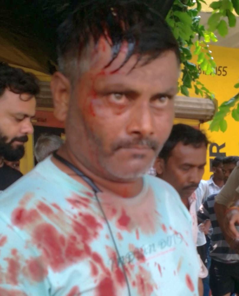 रसूलपुर गिरसा में पिटाई से घायल गुलाब पासी। रसूलपुर गिरसा में पिटाई से घायल गुलाब पासी।