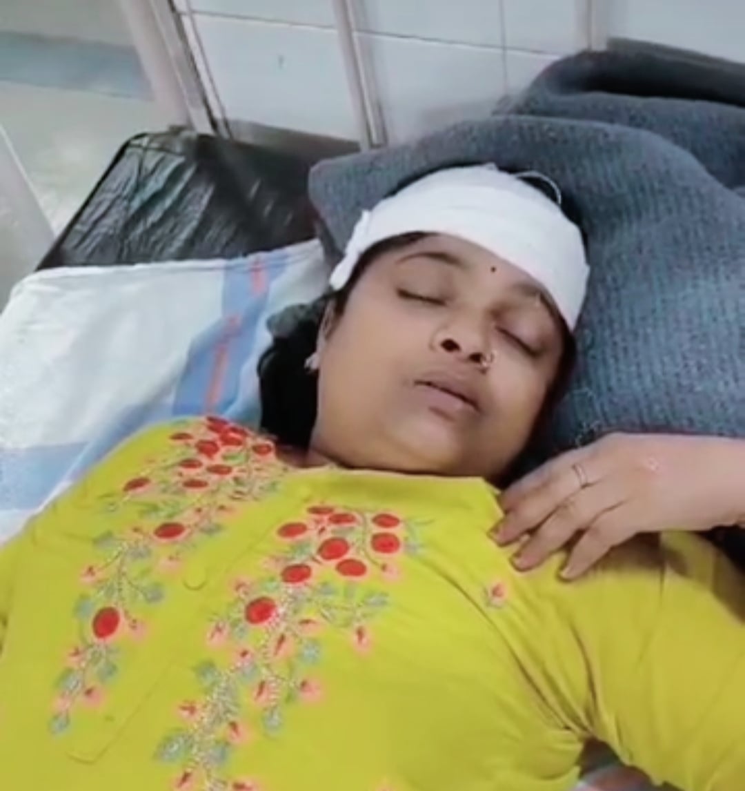 जल संसाधन मंत्री के काफिले मे चल रही पुलिस गाड़ी ने मारी टक्कर....मां बेटी हुए गंभीर घायल..... जल संसाधन मंत्री के काफिले मे चल रही पुलिस गाड़ी ने मारी टक्कर....मां बेटी हुए गंभीर घायल.....