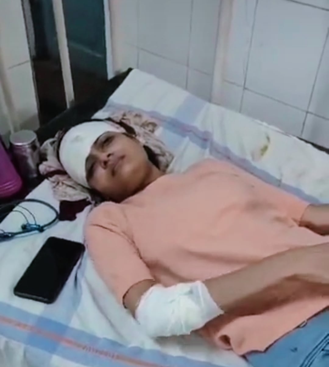 जल संसाधन मंत्री के काफिले मे चल रही पुलिस गाड़ी ने मारी टक्कर....मां बेटी हुए गंभीर घायल..... जल संसाधन मंत्री के काफिले मे चल रही पुलिस गाड़ी ने मारी टक्कर....मां बेटी हुए गंभीर घायल.....