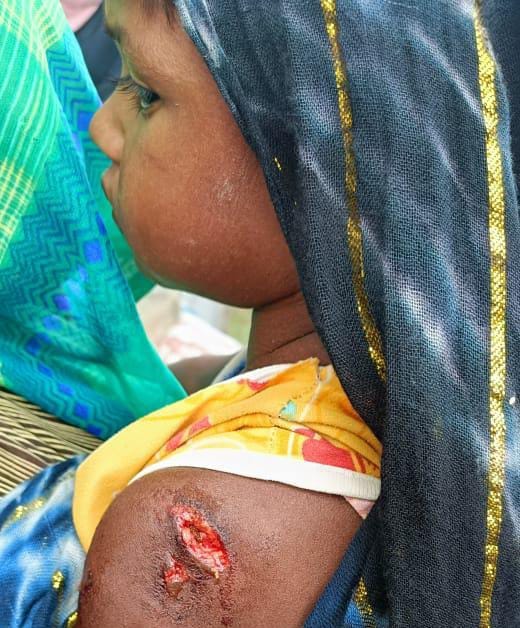 सियार के हमले में घायल मुख्तियार अहमद। संवाद