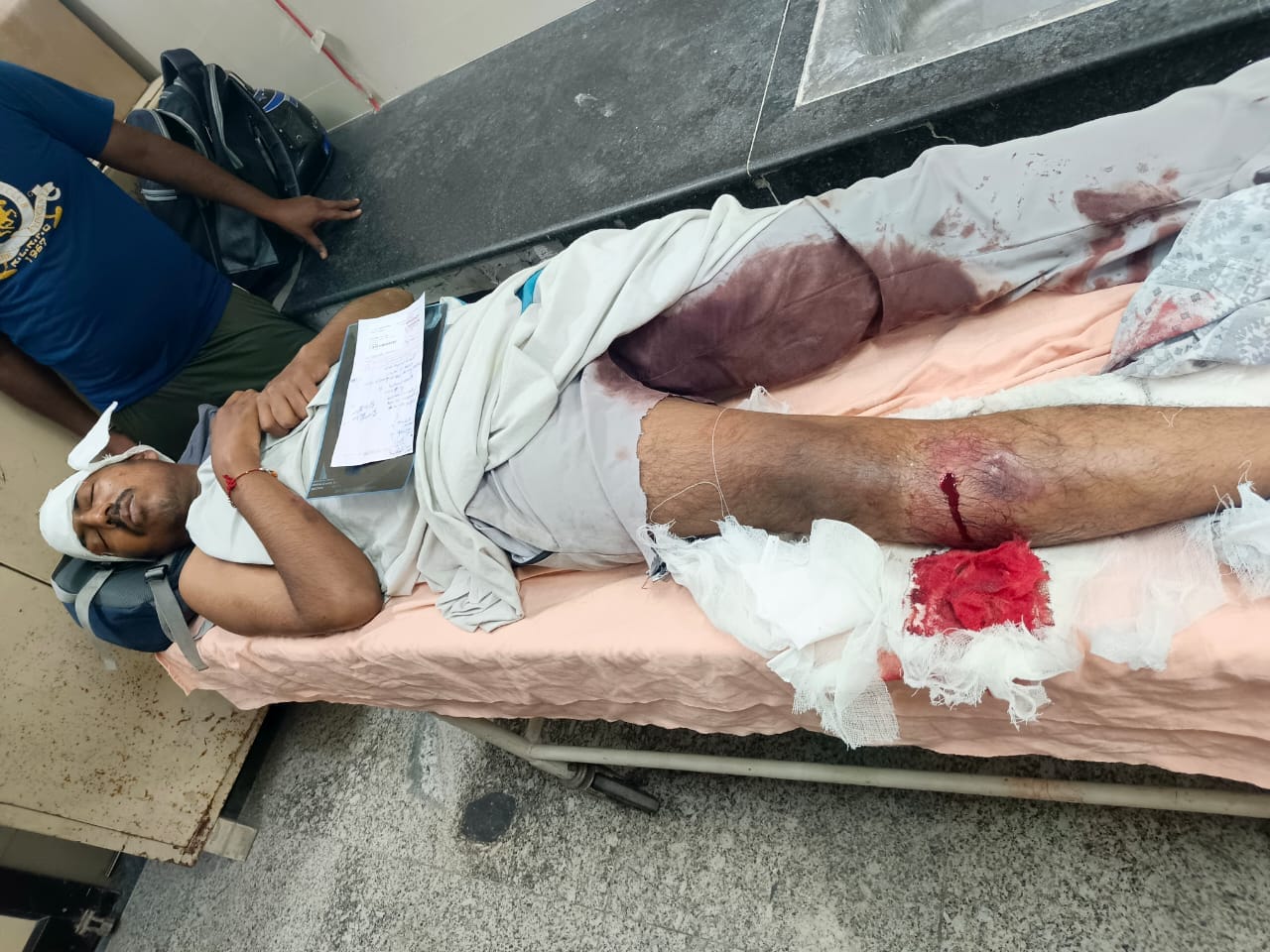 रेलवे स्टेशन पर हुई मारपीट में घायल अभिषेक पंचकूला सेक्टर-6 अस्पताल में उपचाराधीन रेलवे स्टेशन पर हुई मारपीट में घायल अभिषेक पंचकूला सेक्टर-6 अस्पताल में उपचाराधीन