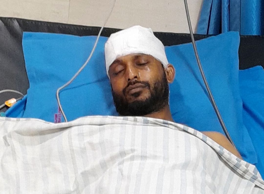 सरायअकिल कस्बे के बुद्धपुरी में पिटाई से घायल सरताज अली। सरायअकिल कस्बे के बुद्धपुरी में पिटाई से घायल सरताज अली।