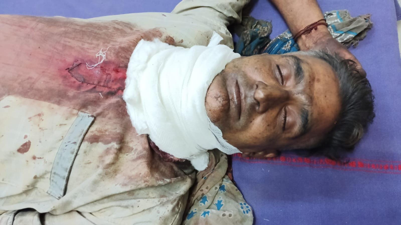 रेवाड़ी। अस्पताल में उपचाराधीन सरोज। स्रोत : परिवार रेवाड़ी। अस्पताल में उपचाराधीन सरोज। स्रोत : परिवार
