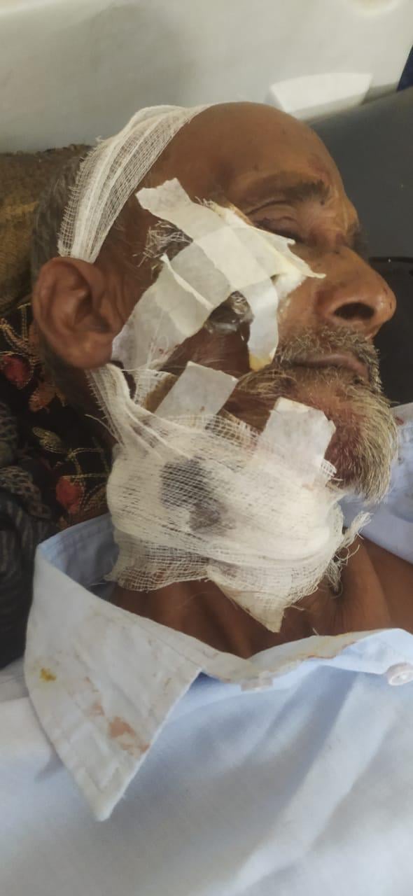 सियार के हमले से घायल फरमान। स्रोत:ग्रामीण सियार के हमले से घायल फरमान। स्रोत:ग्रामीण