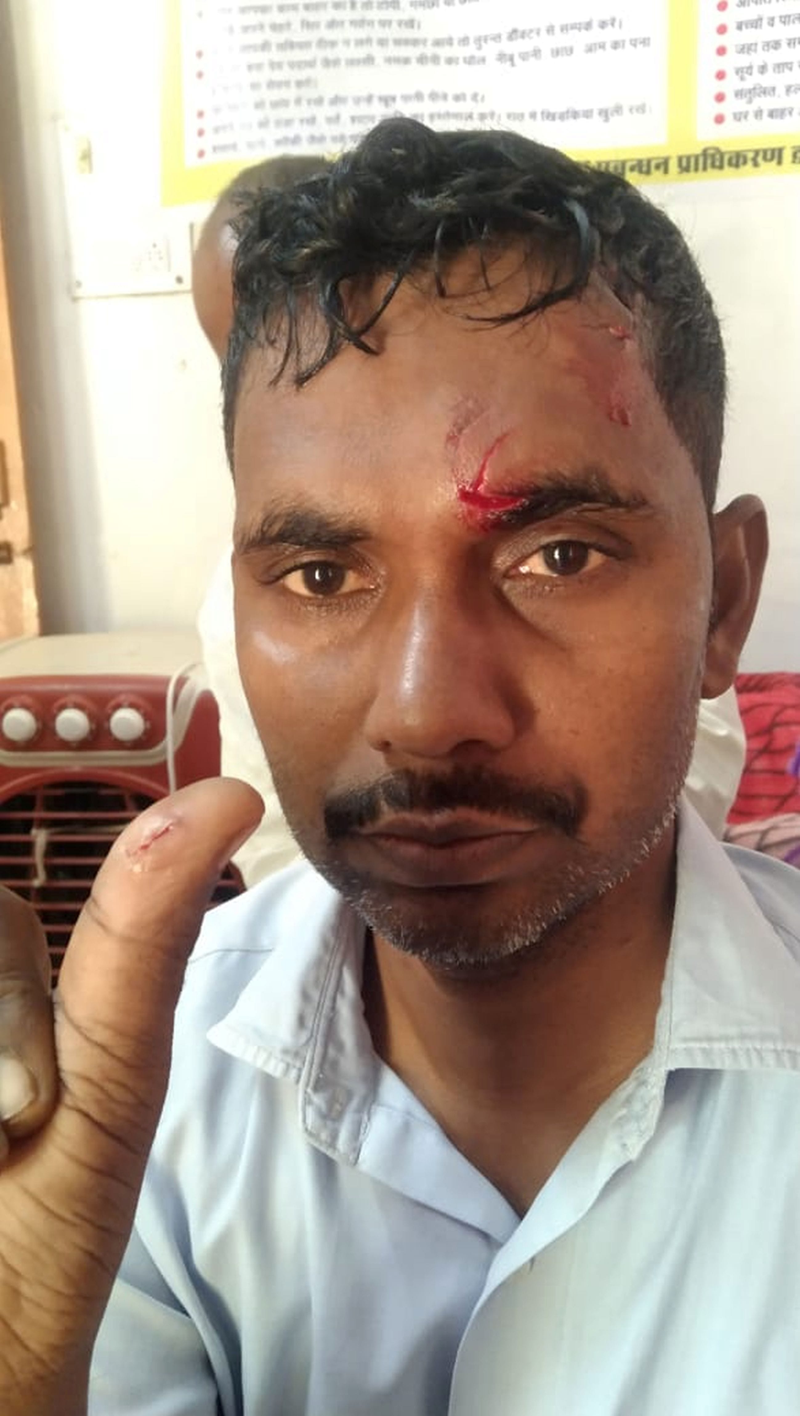 सियार के हमले में घायल राधिका।