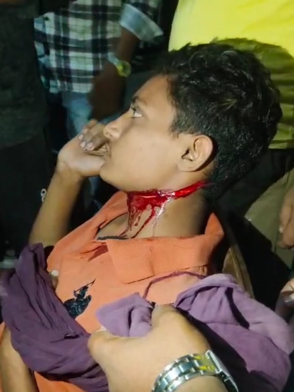 हमले में घायल आदिल। सौजन्य: परिजन