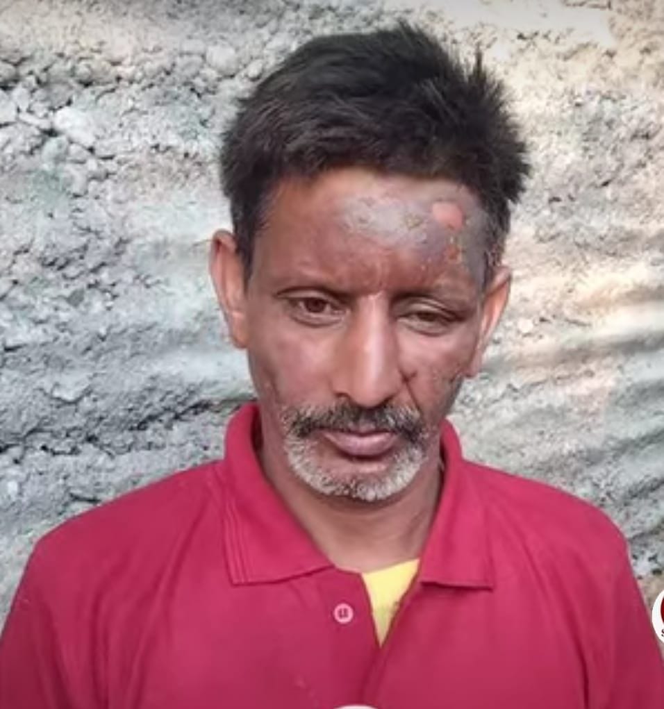ख़ौदा में गैस सिलिंडर में आग लगने से जला रसोईघर। -संवाद ख़ौदा में गैस सिलिंडर में आग लगने से जला रसोईघर। -संवाद