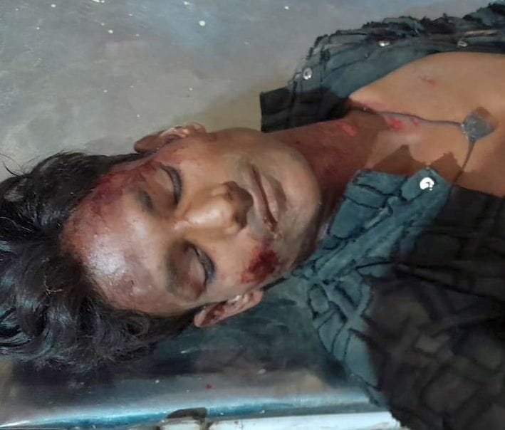 सहसवान कछला मार्ग पर बाइकों भिडंत में घायल युवक। संवाद सहसवान कछला मार्ग पर बाइकों भिडंत में घायल युवक। संवाद
