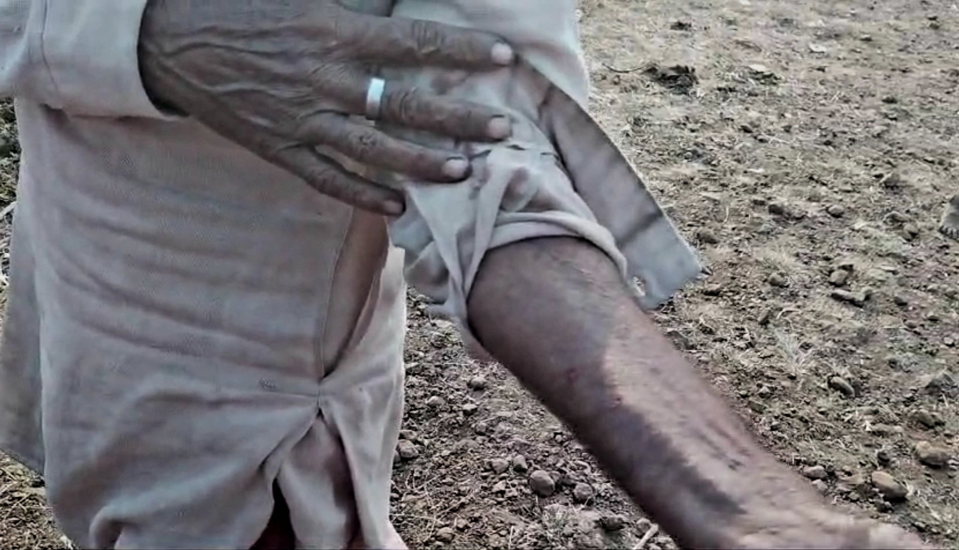 लोमड़ी का हमला लोमड़ी का हमला