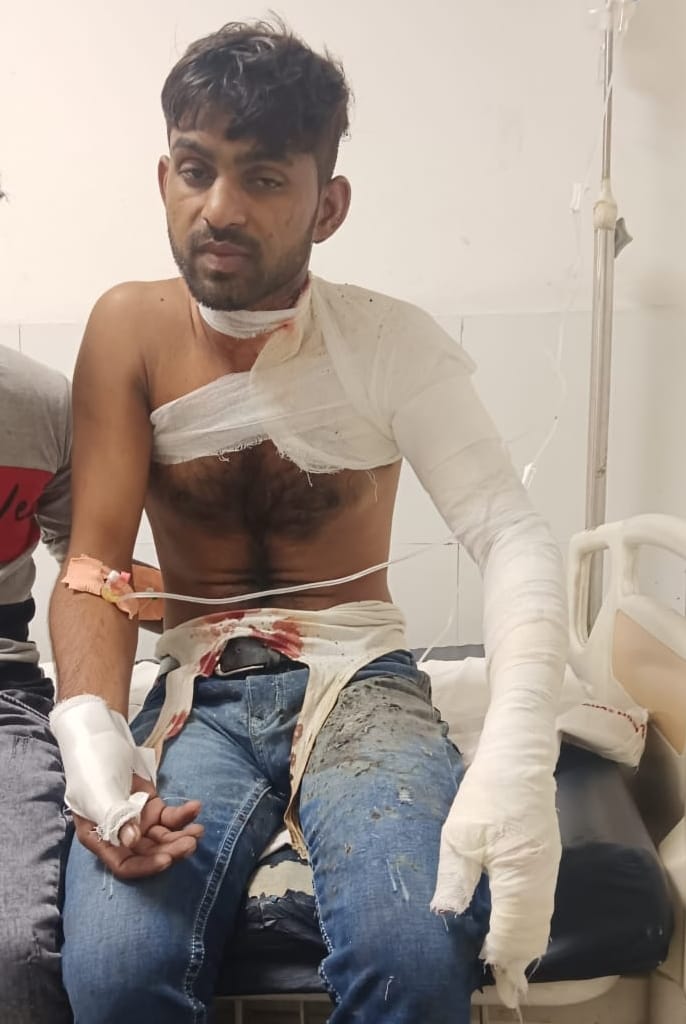 07सीटीके17..घायल आशीष। संवाद 07सीटीके17..घायल आशीष। संवाद