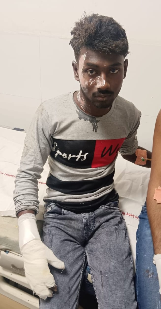 07सीटीके17..घायल आशीष। संवाद 07सीटीके17..घायल आशीष। संवाद
