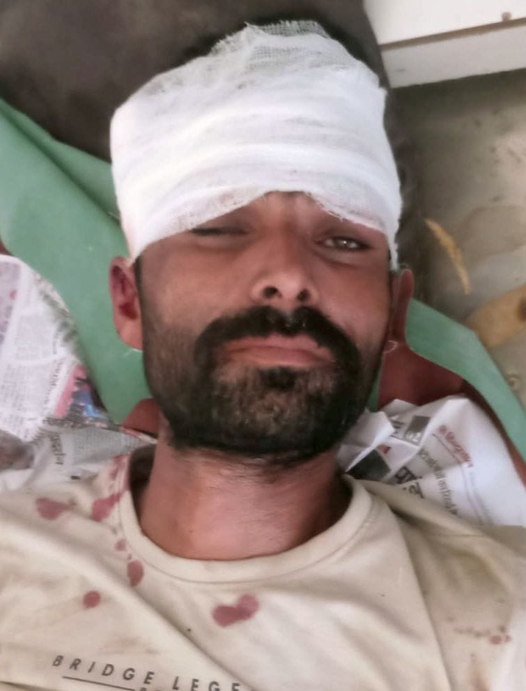 गनसरी गांव के कछार में मारपीट के घटना की जांच करती पुलिस। संवाद गनसरी गांव के कछार में मारपीट के घटना की जांच करती पुलिस। संवाद