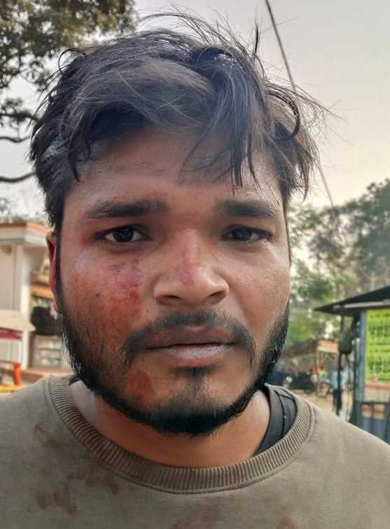 हकीमपुर गांव में पिटाई से घायल अमित उर्फ पवन सिंह। हकीमपुर गांव में पिटाई से घायल अमित उर्फ पवन सिंह।