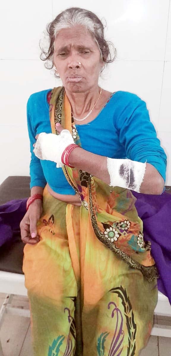 खुटार के गांव नरौठा देवीदास में मारपीट में घायल अनुज। संवाद खुटार के गांव नरौठा देवीदास में मारपीट में घायल अनुज। संवाद