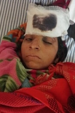 राजगढ़ के समीप सड़क हादसे में घायल श्रद्धालु जगन। संवाद