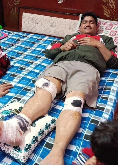 कादरचौक-उझानी रोड पर आग का गोला बनी पिकअप और ईको कार। संवाद कादरचौक-उझानी रोड पर आग का गोला बनी पिकअप और ईको कार। संवाद