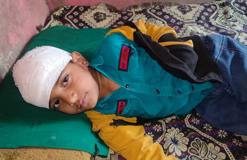 गुलावठी के मोहल्ला रामनगर, कोठी पड़ाव निवासी बंदर के हमले में घायल छात्र अन्साद। संवाद गुलावठी के मोहल्ला रामनगर, कोठी पड़ाव निवासी बंदर के हमले में घायल छात्र अन्साद। संवाद