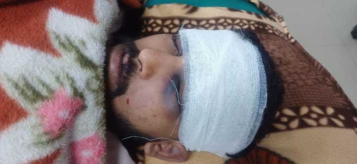 छावनी के नागरिक अस्पताल में उपचाराधीन घायल करण। संवाद छावनी के नागरिक अस्पताल में उपचाराधीन घायल करण। संवाद