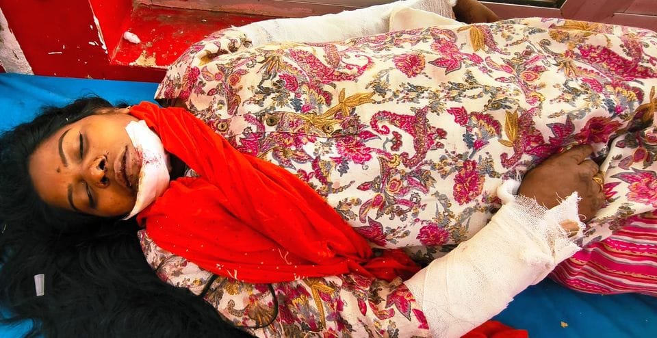 कैमा गांव में हादसे के बाद मेडिकल कॉलेज अस्पताल में भर्ती मरीज। संवाद कैमा गांव में हादसे के बाद मेडिकल कॉलेज अस्पताल में भर्ती मरीज। संवाद
