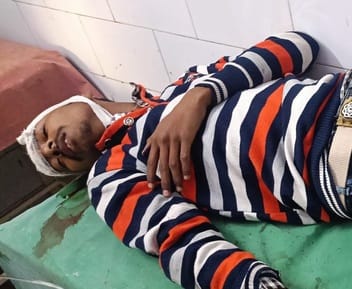 बीसलपुर सामुदायिक स्वास्थ्य केंद्र में भर्ती घायल छात्र हिमांशु।संवाद बीसलपुर सामुदायिक स्वास्थ्य केंद्र में भर्ती घायल छात्र हिमांशु।संवाद