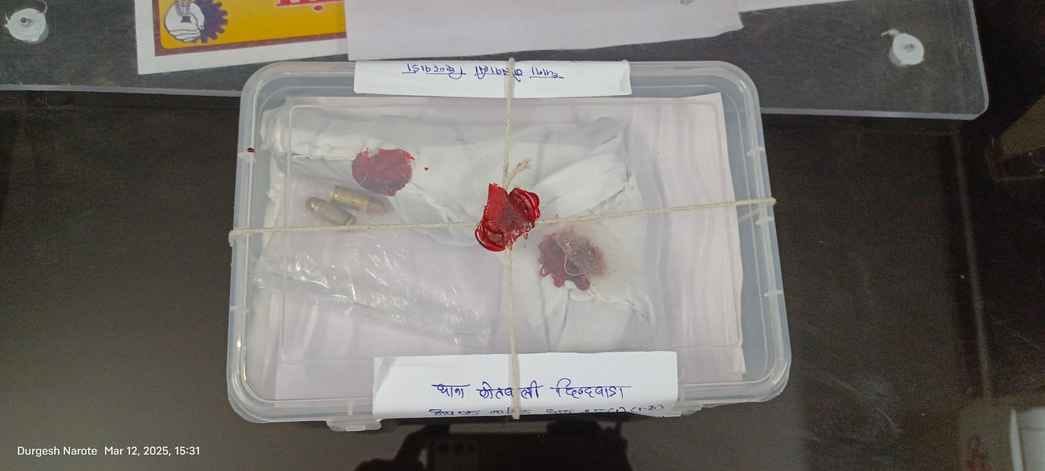 पुलिस की जानकारी