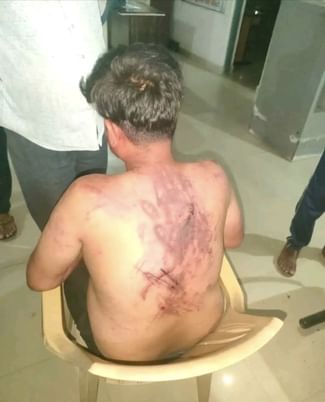 मारपीट घायल का वीडियो 