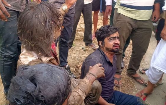 अलापुर में पानी से भरे गड्ढे में घुसी कार। संवाद