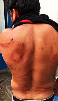 भावलखेड़ा के ग्राम चक परमाली में विवाद के बाद क्षतिग्रस्त बरातियों की कार। संवाद भावलखेड़ा के ग्राम चक परमाली में विवाद के बाद क्षतिग्रस्त बरातियों की कार। संवाद