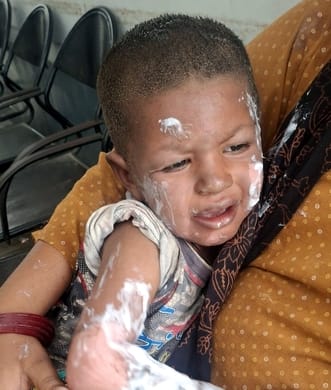 रेहड़ में गैस सिलेंडर का पाइप लीक होने से लगी आग से झुलसी महिला। संवाद रेहड़ में गैस सिलेंडर का पाइप लीक होने से लगी आग से झुलसी महिला। संवाद