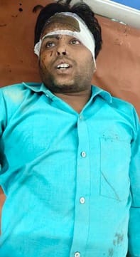 गांव महुआ पाठक के पास कार ई रिक्शा की टक्कर में घायल शिवम। संवाद गांव महुआ पाठक के पास कार ई रिक्शा की टक्कर में घायल शिवम। संवाद