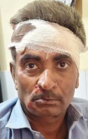 गांव महुआ पाठक के पास कार ई रिक्शा की टक्कर में घायल शिवम। संवाद गांव महुआ पाठक के पास कार ई रिक्शा की टक्कर में घायल शिवम। संवाद