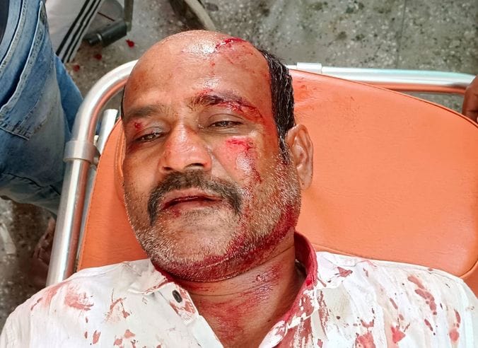 थुलगुला गांव में नहर के समीप विद्युत पोल से टकराई कार। संवाद थुलगुला गांव में नहर के समीप विद्युत पोल से टकराई कार। संवाद