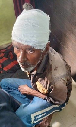 गढी कलंजरी में दो पक्षों में मारपीट व फायरिंग की खबर से संबंधित फोटो। घायल युवक बंटी