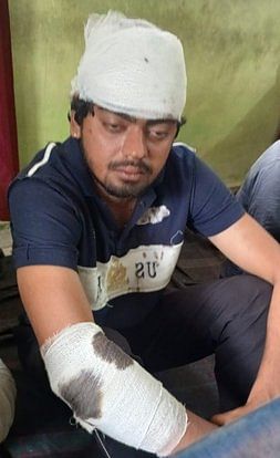 गढी कलंजरी में दो पक्षों में मारपीट व फायरिंग की खबर से संबंधित फोटो। घायल युवक बंटी