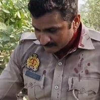पत्थर लगने से घायल सिपाही-स्रोत सोशल मीडिया