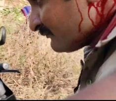 पत्थर लगने से घायल सिपाही-स्रोत सोशल मीडिया