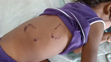 घटना की जानकारी देते राजेंद्र वसुनिया