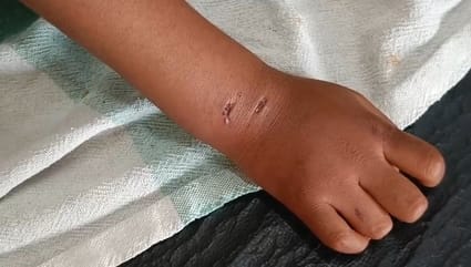 घटना की जानकारी देते राजेंद्र वसुनिया